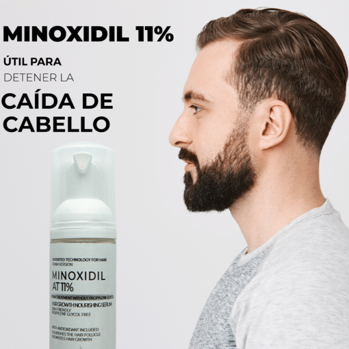 minoxidil 11 porciento caida de cabello